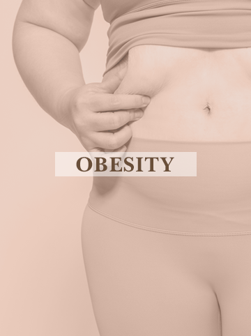 OBESITY